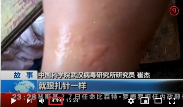 Video shows Wuhan lab scientists admit to being bitten by bats
